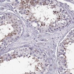 Klkbl4 Antibody, Novus Biologicals:Antibodies:Primary Antibodies