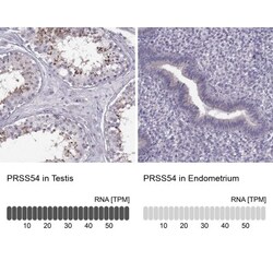 Klkbl4 Antibody, Novus Biologicals:Antibodies:Primary Antibodies