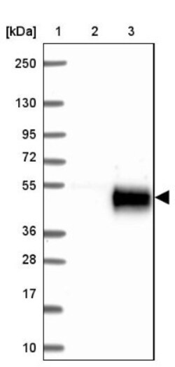 Klkbl4 Antibody, Novus Biologicals:Antibodies:Primary Antibodies