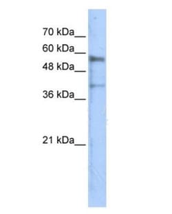 Kremen-1 Antibody, Novus Biologicals 100 &mu;L | Buy Online | Novus Biologicals | Fisher Scientific