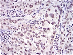 Ku70/XRCC6 Antibody (2F7F5) - BSA Free, Novus Biologicals:Antibodies:Primary