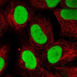 Ku70/XRCC6 Antibody, Novus Biologicals:Antibodies:Primary Antibodies