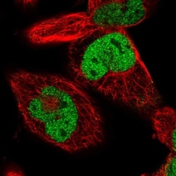Ku70/XRCC6 Antibody, Novus Biologicals:Antibodies:Primary Antibodies