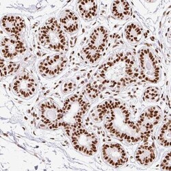Ku70/XRCC6 Antibody, Novus Biologicals:Antibodies:Primary Antibodies