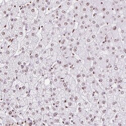Ku70/XRCC6 Antibody, Novus Biologicals:Antibodies:Primary Antibodies