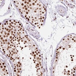Ku70/XRCC6 Antibody, Novus Biologicals:Antibodies:Primary Antibodies