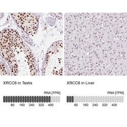 Ku70/XRCC6 Antibody, Novus Biologicals:Antibodies:Primary Antibodies