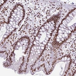 Ku70/XRCC6 Antibody, Novus Biologicals:Antibodies:Primary Antibodies
