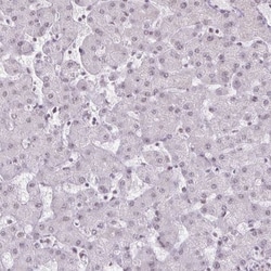Ku70/XRCC6 Antibody, Novus Biologicals:Antibodies:Primary Antibodies