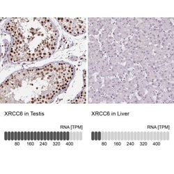 Ku70/XRCC6 Antibody, Novus Biologicals:Antibodies:Primary Antibodies