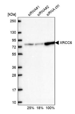 Ku70/XRCC6 Antibody, Novus Biologicals:Antibodies:Primary Antibodies