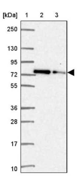 Ku70/XRCC6 Antibody, Novus Biologicals:Antibodies:Primary Antibodies