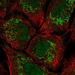 Kv12.2 Antibody, Novus Biologicals 0.1mL; Unlabeled:Antibodies, Polyclonal