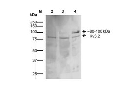 Kv3.2 Antibody (S410-17), Novus Biologicals 100&mu;g; Unlabeled:Antibodies,