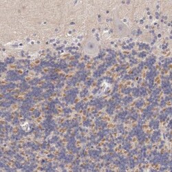 Kv4.1 Antibody, Novus Biologicals 0.1mL; Unlabeled:Antibodies, Polyclonal