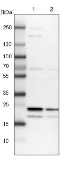 Kv6.1 Antibody, Novus Biologicals 0.1mL; Unlabeled:Antibodies, Polyclonal