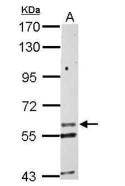 Kv6.1 Antibody, Novus Biologicals™
