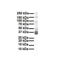 KvBeta2 Antibody, Novus Biologicals 100&mu;L; Unlabeled:Antibodies, Polyclonal