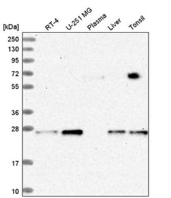KxDL motif containing 1 Antibody, Novus Biologicals 0.1mL; Unlabeled:Antibodies,