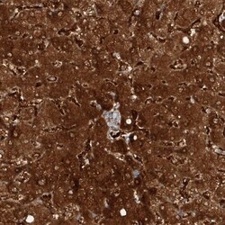 Kynureninase Antibody, Novus Biologicals 0.1mL; Unlabeled:Antibodies, Polyclonal
