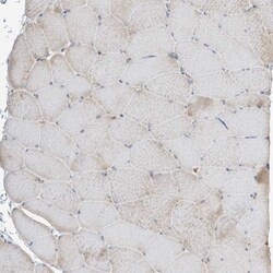 Kynureninase Antibody, Novus Biologicals 0.1mL; Unlabeled:Antibodies, Polyclonal