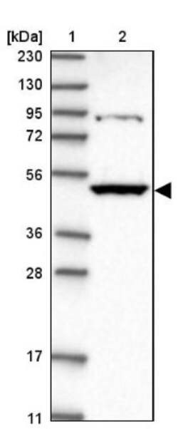 Kynureninase Antibody, Novus Biologicals 0.1mL; Unlabeled:Antibodies, Polyclonal