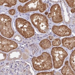 L3HYPDH Antibody, Novus Biologicals 25 &mu;L, Unlabeled:Antibodies, Polyclonal