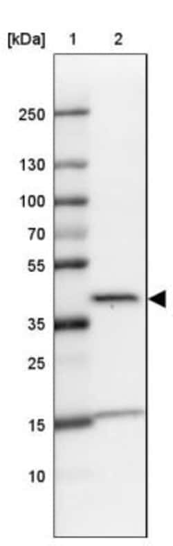 L3HYPDH Antibody, Novus Biologicals 25 &mu;L, Unlabeled:Antibodies, Polyclonal