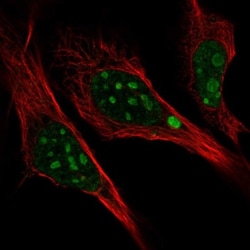 L3MBTL3 Antibody, Novus Biologicals:Antibodies:Primary Antibodies