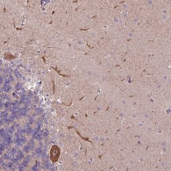 L3MBTL3 Antibody, Novus Biologicals:Antibodies:Primary Antibodies