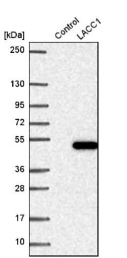 LACC1 Antibody, Novus Biologicals 25 &mu;L, Unconjugated:Antibodies, Polyclonal