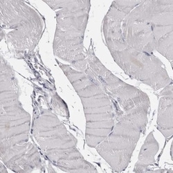 LAD1 Antibody, Novus Biologicals 0.1mL; Unlabeled:Antibodies, Polyclonal