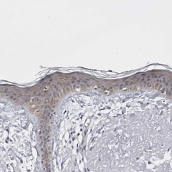 LAD1 Antibody, Novus Biologicals 0.1mL; Unlabeled:Antibodies, Polyclonal