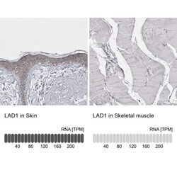 LAD1 Antibody, Novus Biologicals 0.1mL; Unlabeled:Antibodies, Polyclonal