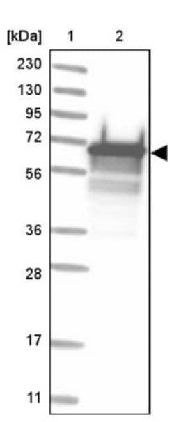 LAD1 Antibody, Novus Biologicals 0.1mL; Unlabeled:Antibodies, Polyclonal