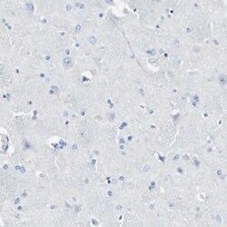 LAG-3 Antibody, Novus Biologicals 0.1mL; Unlabeled:Antibodies, Polyclonal