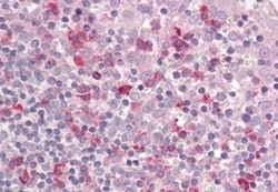 LAIR1 Antibody, Novus Biologicals 0.1mg; Unlabeled:Antibodies, Polyclonal