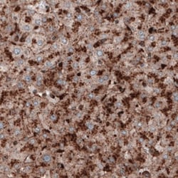 LAMP-1/CD107a Antibody (CL3484), Novus Biologicals:Antibodies:Primary Antibodies