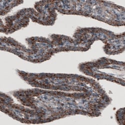 LAMP-1/CD107a Antibody (CL3484), Novus Biologicals:Antibodies:Primary Antibodies