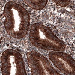 LAMP-1/CD107a Antibody (CL3484), Novus Biologicals:Antibodies:Primary Antibodies