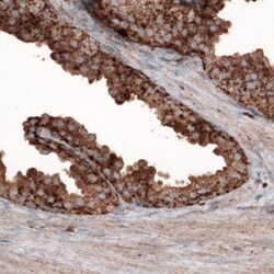 LAMP-1/CD107a Antibody (CL3484), Novus Biologicals:Antibodies:Primary Antibodies
