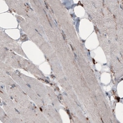 LAMP-1/CD107a Antibody (CL3484), Novus Biologicals:Antibodies:Primary Antibodies