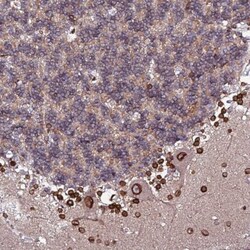 LAP1B Antibody, Novus Biologicals:Antibodies:Primary Antibodies