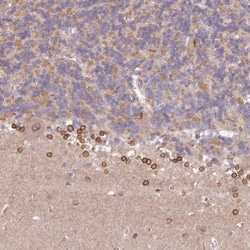 LAP1B Antibody, Novus Biologicals 25 &mu;L; Unlabeled:Antibodies, Polyclonal