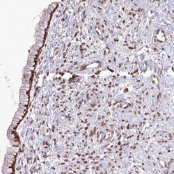 LAP1B Antibody, Novus Biologicals 25 &mu;L; Unlabeled:Antibodies, Polyclonal