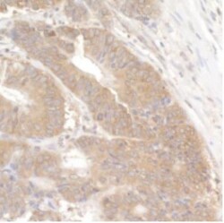 LARP1 Antibody, Novus Biologicals 0.1mL; Unlabeled:Antibodies, Polyclonal