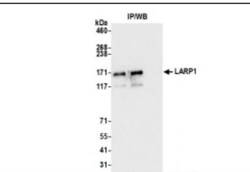 LARP1 Antibody, Novus Biologicals 0.1mL; Unlabeled:Antibodies, Polyclonal