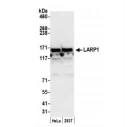 LARP1 Antibody, Novus Biologicals 0.1mL; Unlabeled:Antibodies, Polyclonal