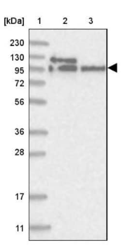 LARP5 Antibody, Novus Biologicals 25 &mu;L; Unlabeled:Antibodies, Polyclonal