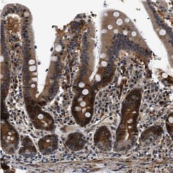 LARP6 Antibody, Novus Biologicals:Antibodies:Primary Antibodies